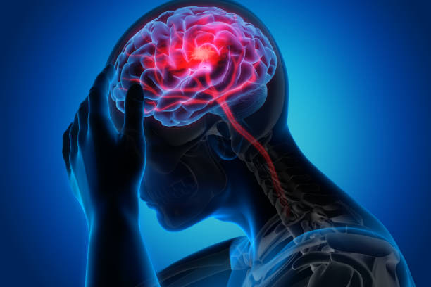 Stroke & Neurological Rehabilitation